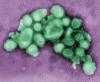 2009 H1N1 influenza virus