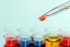 Pipette and test tubes