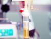 Plasma transfusion
