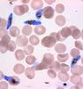 Plasmodium falciparum