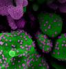 SARS-CoV-2 viruses under microscope