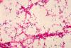 This is a photomicrograph of Streptococcus pneumoniae bacteria having been grown from a blood culture.