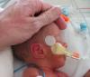 Premature baby