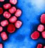 Monkeypox viruses as seen through a microscope