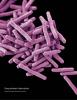 Drug-resistant Mycobacterium tuberculosis