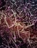 COVID-19 virus, highly magnified