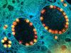 SARS-CoV-2 viruses, highly magnified