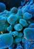 SARS-CoV-2 viruses magnified