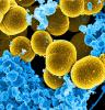 Staphylococcus aureus