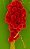 Staphylococcus aureus