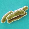 Mycobacterium tuberculosis highly magnified