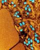 Monkeypox viruses highly magnified