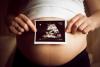 Ultrasound image on pregnant belly