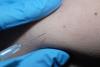 Vaccine injection