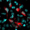 Zika-infected neural cells
