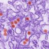 Zika via electron microscope