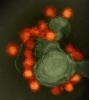 Zika virus from microcephaly case