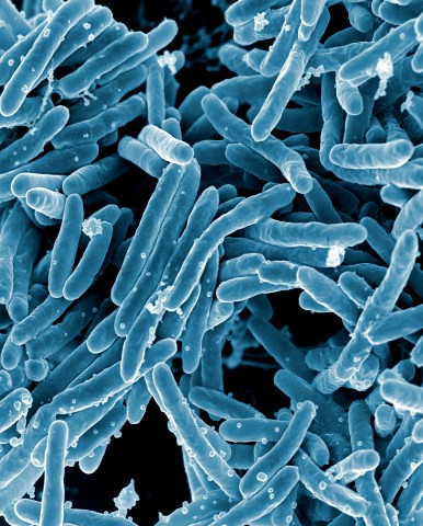 tuberculosis